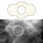 Spee-D-Ring™ Mammography Skin Marker Mole Radiolucent NO BURNOUT™ 1/2" Inner Diameter, 100 per Box