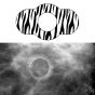 Spee-D-Ring™ Mammography Skin Marker Mole Radiolucent NO BURNOUT™ Zebra Print 1/2" Inner Diameter, 100 per Box