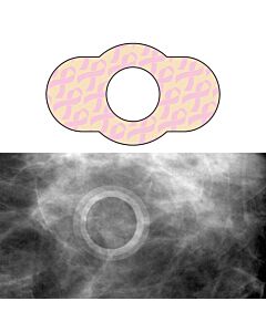 Spee-D-Ring™ Mammography Skin Marker Mole Radiolucent NO BURNOUT™ Repositionable 1/2" Inner Diameter, 100 per Box