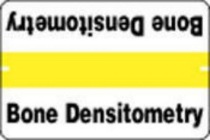 Label Wraparound Paper Permanent Bone Densitometry 1" Core 1-1/2" x 1 White with Yellow,,1000 per Roll