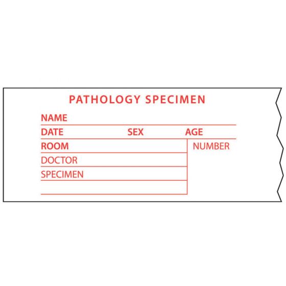 Lab Communication Tape (Removable)pathology Specimen 2" x500" White - 143 Imprints per Roll