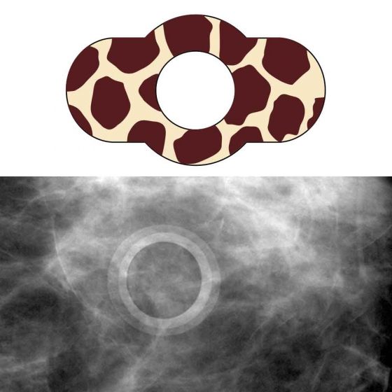 Spee-D-Ring™ Mammography Skin Marker Mole Radiolucent NO BURNOUT™ Giraffe Print 1/2" Inner Diameter, 100 per Box