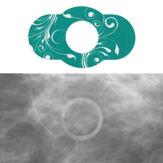 Spee-D-Ring™ 3D Digital Breast Tomosynthesis Mammography Mole Marker 1/2" Inner Diameter