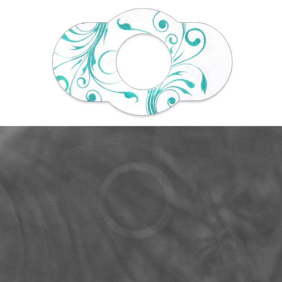 Spee-D-Ring™ 3D Digital Breast Tomosynthesis Soft Mark Mammography Mole Marker 1/2" Inner Diameter
